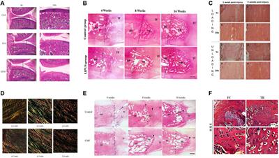 External stimulation: A potential therapeutic strategy for tendon-bone healing